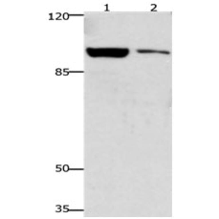 GSN Antibody from Signalway Antibody (31204) - Antibodies.com