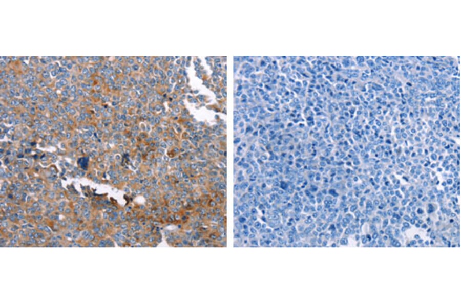 GSN Antibody from Signalway Antibody (31204) - Antibodies.com