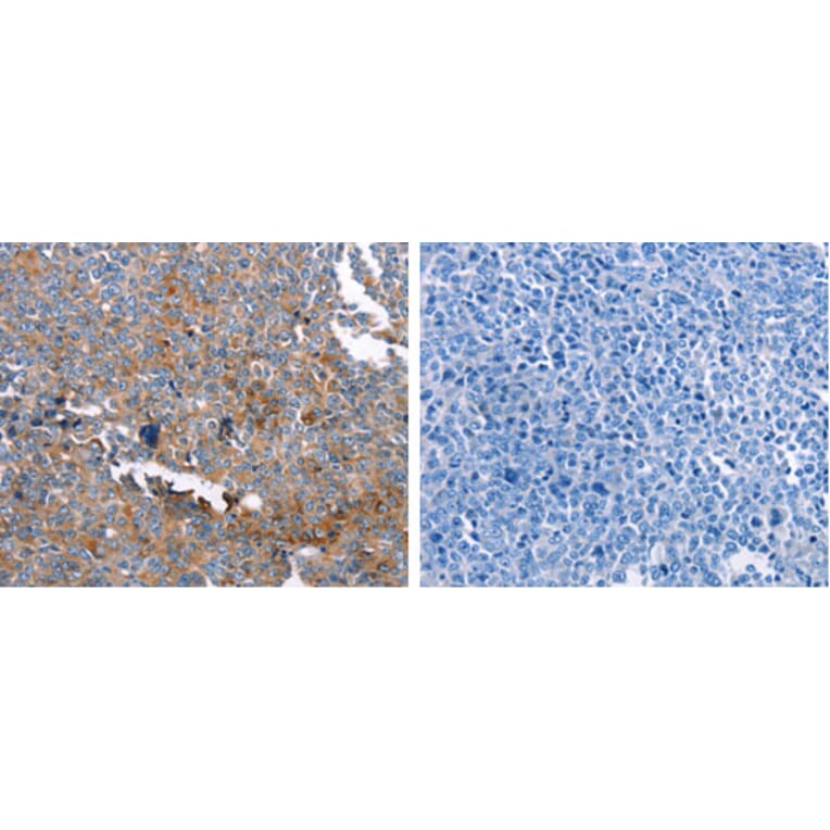 GSN Antibody from Signalway Antibody (31204) - Antibodies.com