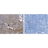 GSN Antibody from Signalway Antibody (31204) - Antibodies.com