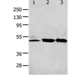 F2R Antibody from Signalway Antibody (31256) - Antibodies.com