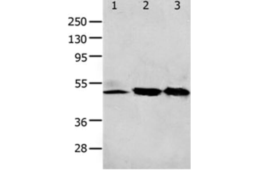 F2R Antibody from Signalway Antibody (31256) - Antibodies.com