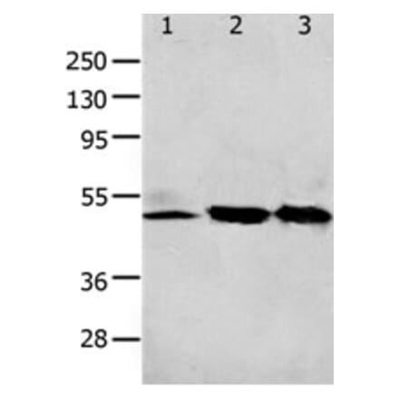 F2R Antibody from Signalway Antibody (31256) - Antibodies.com