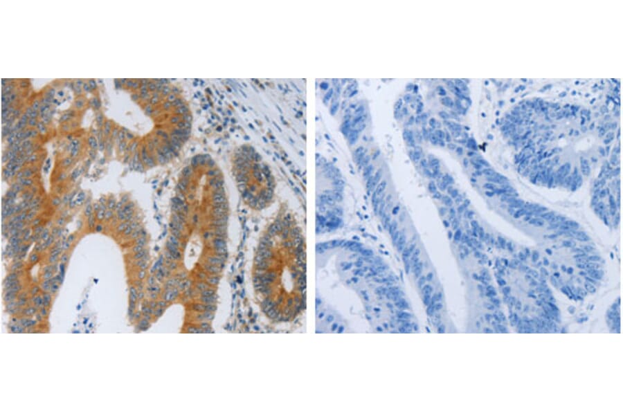 F2R Antibody from Signalway Antibody (31256) - Antibodies.com