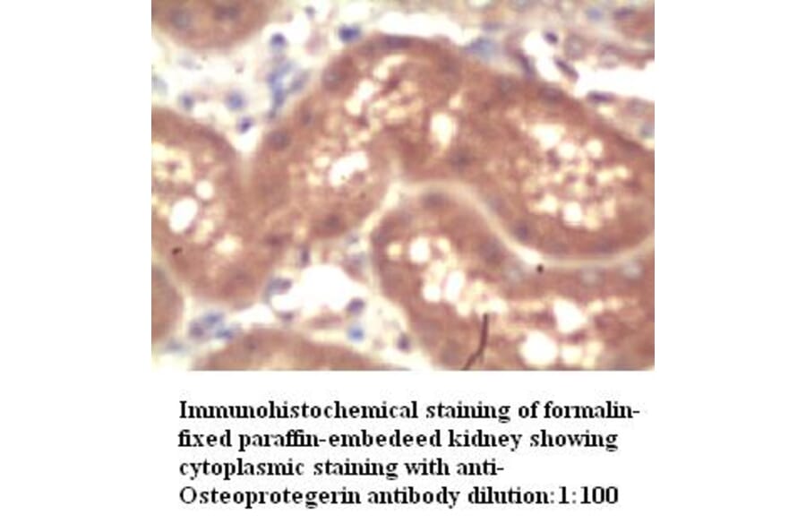 OPG Antibody from Signalway Antibody (39272) - Antibodies.com