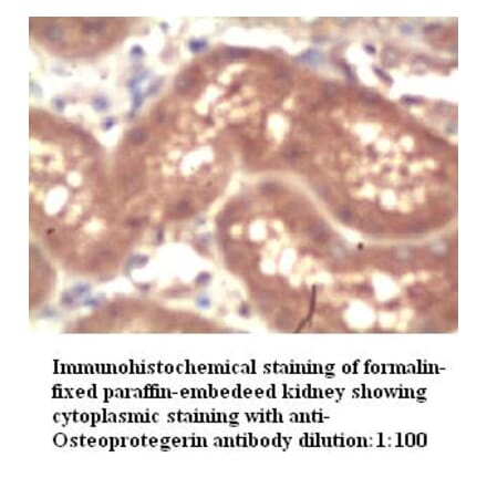 OPG Antibody from Signalway Antibody (39272) - Antibodies.com