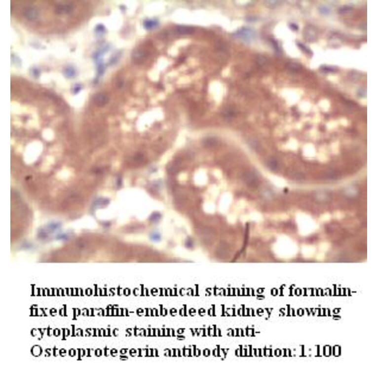 OPG Antibody from Signalway Antibody (39272) - Antibodies.com
