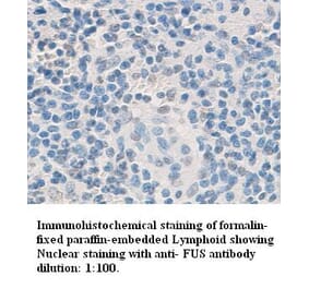 Fus Antibody from Signalway Antibody (39335) - Antibodies.com