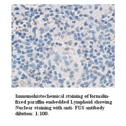 Fus Antibody from Signalway Antibody (39335) - Antibodies.com