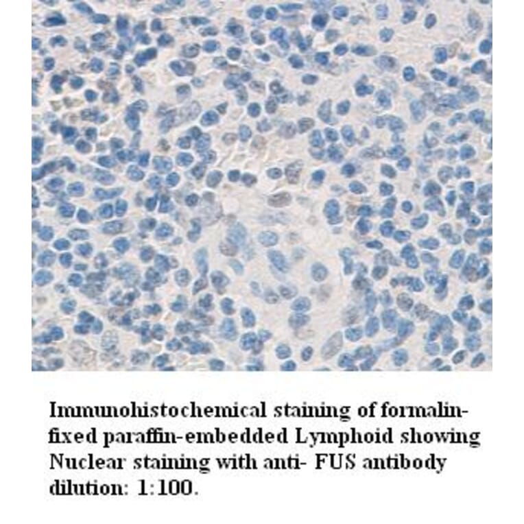 Fus Antibody from Signalway Antibody (39335) - Antibodies.com