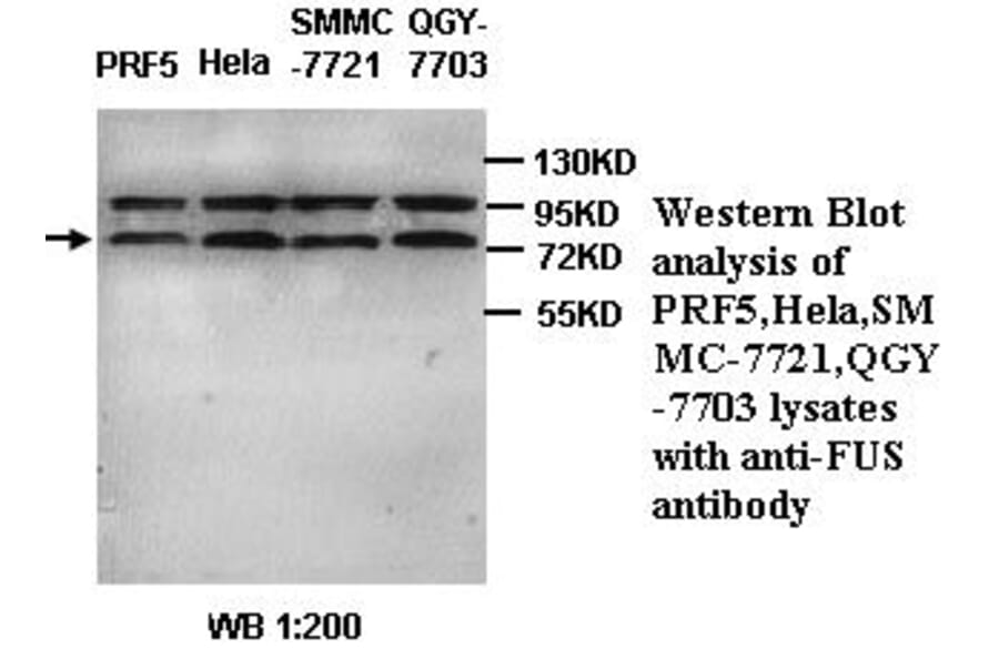 Fus Antibody from Signalway Antibody (39335) - Antibodies.com