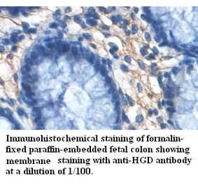 HGD Antibody from Signalway Antibody (39460) - Antibodies.com