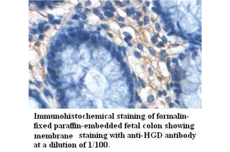 HGD Antibody from Signalway Antibody (39460) - Antibodies.com