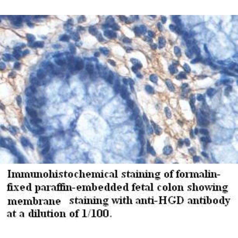 HGD Antibody from Signalway Antibody (39460) - Antibodies.com