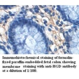 HGD Antibody from Signalway Antibody (39460) - Antibodies.com
