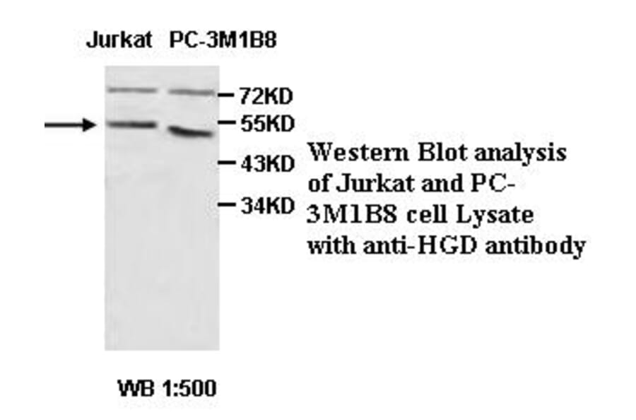HGD Antibody from Signalway Antibody (39460) - Antibodies.com