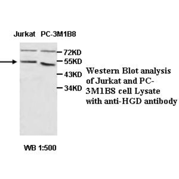 HGD Antibody from Signalway Antibody (39460) - Antibodies.com