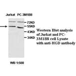 HGD Antibody from Signalway Antibody (39460) - Antibodies.com