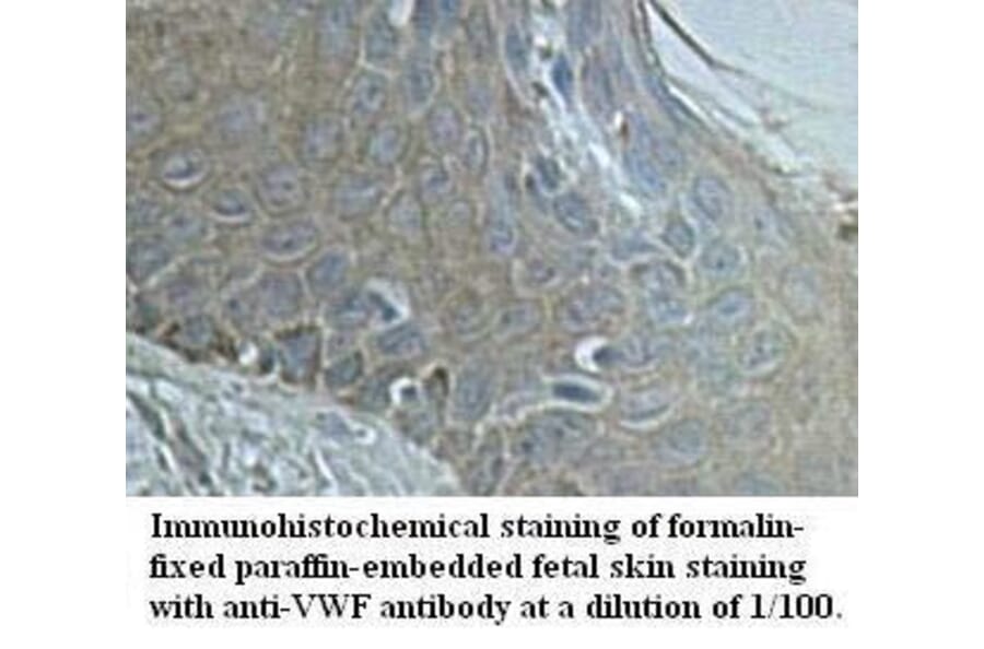 VWF Antibody from Signalway Antibody (39594) - Antibodies.com