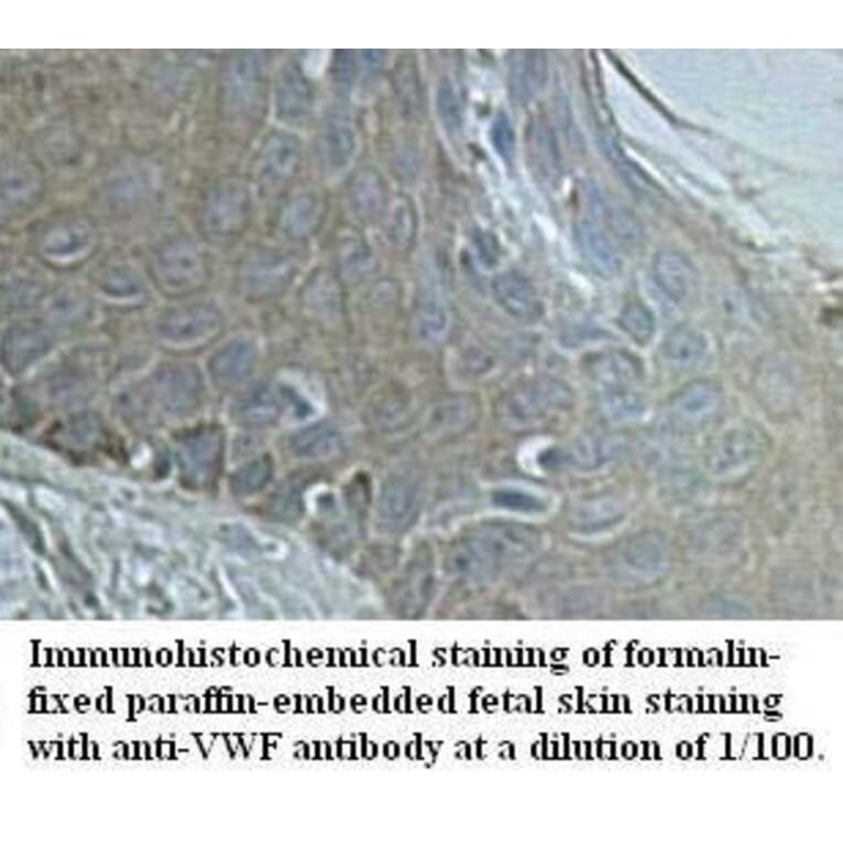 VWF Antibody from Signalway Antibody (39594) - Antibodies.com