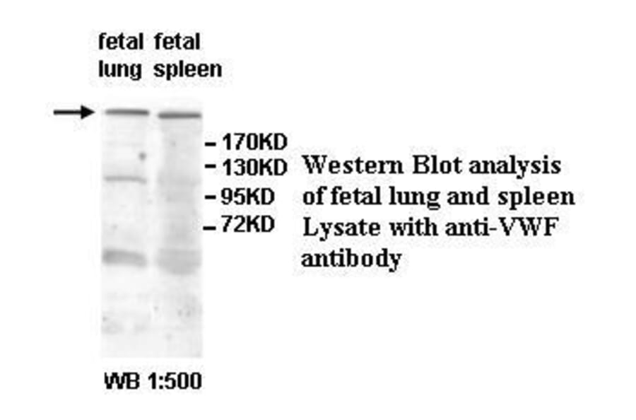 VWF Antibody from Signalway Antibody (39594) - Antibodies.com