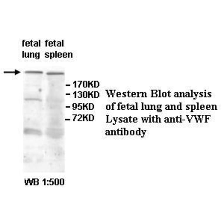 VWF Antibody from Signalway Antibody (39594) - Antibodies.com