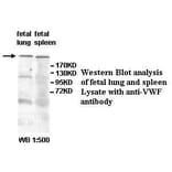VWF Antibody from Signalway Antibody (39594) - Antibodies.com