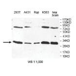 ESD Antibody from Signalway Antibody (39801) - Antibodies.com