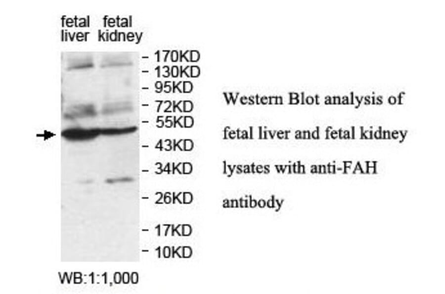 FAH Antibody from Signalway Antibody (39846) - Antibodies.com
