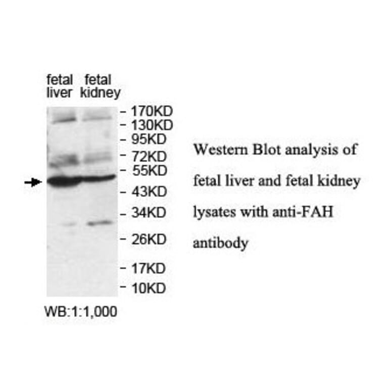 FAH Antibody from Signalway Antibody (39846) - Antibodies.com