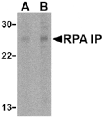 Western blot - RPA Interacting Protein Antibody from Signalway Antibody (24482) - Antibodies.com