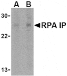 Western blot - RPA Interacting Protein Antibody from Signalway Antibody (24482) - Antibodies.com
