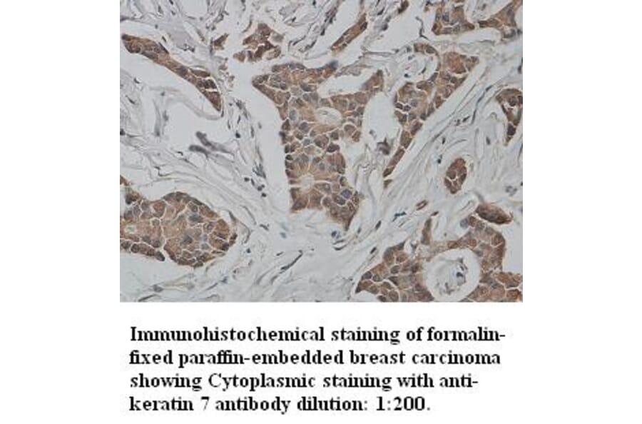 keratin 7/Cytokeratin 7 Antibody from Signalway Antibody (39340) - Antibodies.com