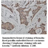 keratin 7/Cytokeratin 7 Antibody from Signalway Antibody (39340) - Antibodies.com