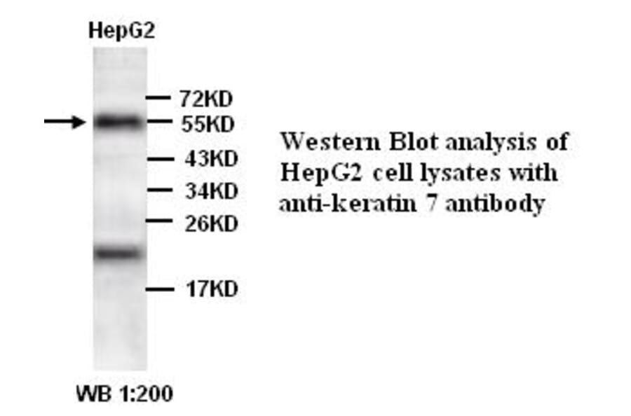 keratin 7/Cytokeratin 7 Antibody from Signalway Antibody (39340) - Antibodies.com
