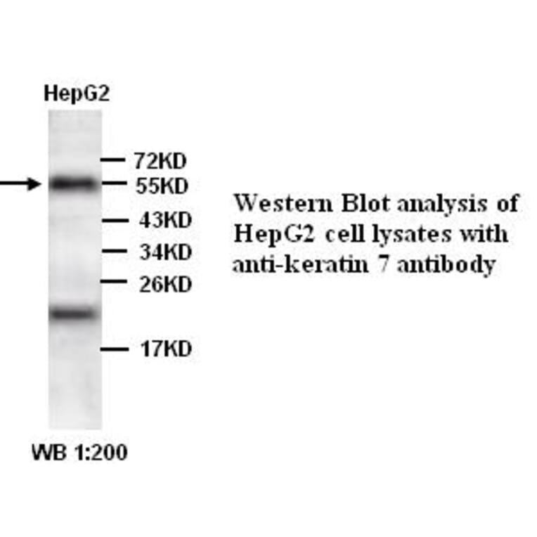 keratin 7/Cytokeratin 7 Antibody from Signalway Antibody (39340) - Antibodies.com