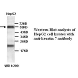 keratin 7/Cytokeratin 7 Antibody from Signalway Antibody (39340) - Antibodies.com