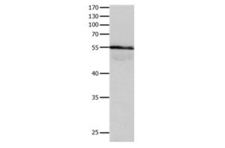 HP Antibody from Signalway Antibody (31083) - Antibodies.com