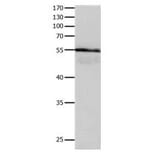 HP Antibody from Signalway Antibody (31083) - Antibodies.com