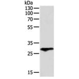 F3 Antibody from Signalway Antibody (31131) - Antibodies.com