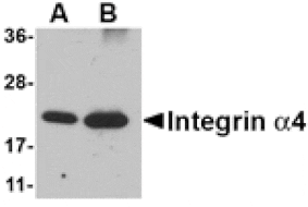 Western blot - Integrin alpha 4 Antibody from Signalway Antibody (24765) - Antibodies.com