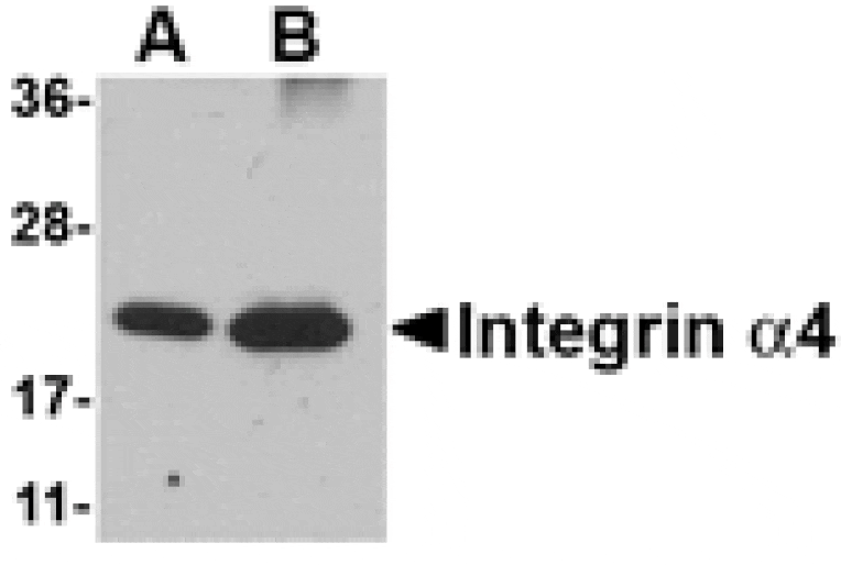 Western blot - Integrin alpha 4 Antibody from Signalway Antibody (24765) - Antibodies.com
