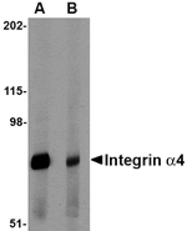 Western blot - Integrin alpha 4 Antibody from Signalway Antibody (24770) - Antibodies.com