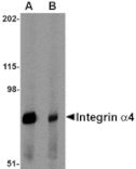 Western blot - Integrin alpha 4 Antibody from Signalway Antibody (24770) - Antibodies.com