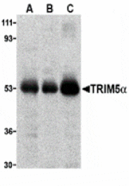 Western blot - TRIM5 alpha Antibody from Signalway Antibody (24225) - Antibodies.com