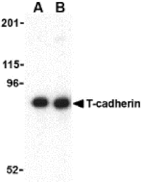 Western blot - T-cadherin Antibody from Signalway Antibody (24338) - Antibodies.com