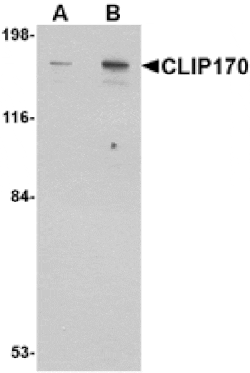 Western blot - CLIP170 Antibody from Signalway Antibody (24708) - Antibodies.com
