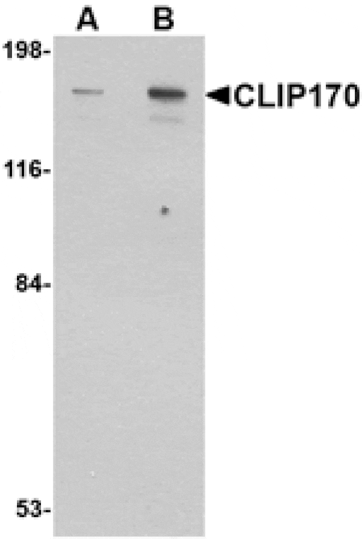 Western blot - CLIP170 Antibody from Signalway Antibody (24708) - Antibodies.com