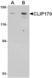 Western blot - CLIP170 Antibody from Signalway Antibody (24708) - Antibodies.com