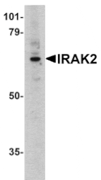 Western blot - IRAK-2 Antibody from Signalway Antibody (24084) - Antibodies.com